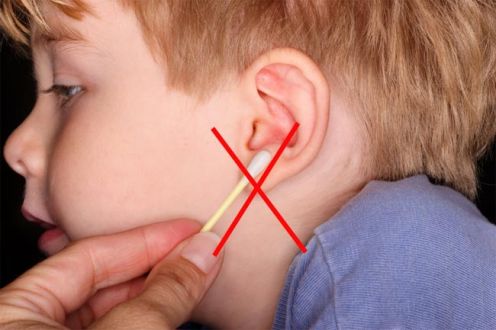 اسباب و علاج انسداد الأذن الشمعي