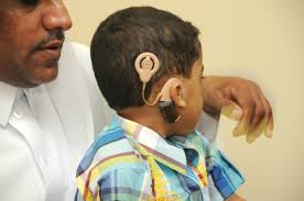 فريق كويتي ينجح بزراعة قوقعتين لطفلين فقدا السمع منذ الولادة