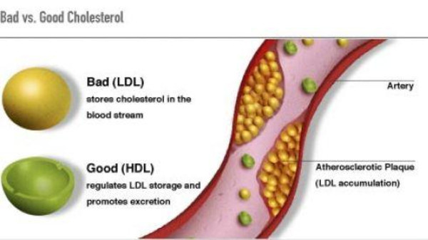 "الكوليسترول الجيد".. قد يكون ضارا في بعض الأحيان