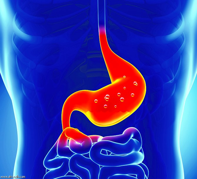 حموضة المعدة.. أسبابها والوقاية منها