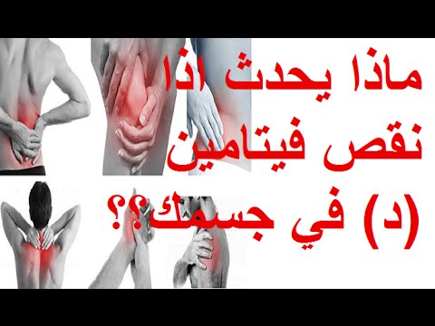 علاقة فيتامين د بالعضلات