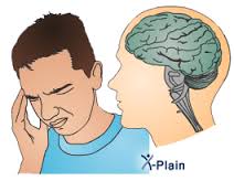 اعراض النزيف الداخلي في الرأس