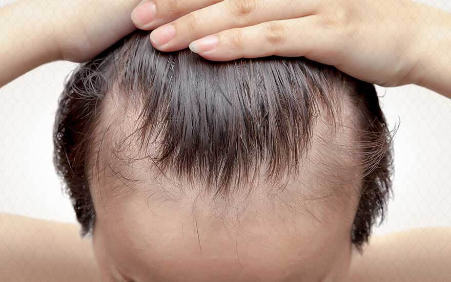 أهم العوامل التي تأثر على الشعر الصحي ونموه